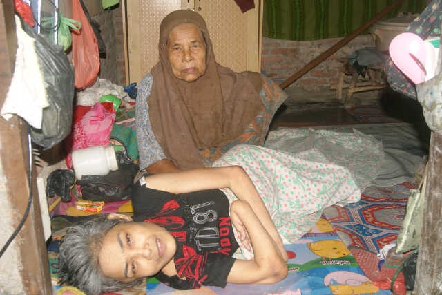 Jamilah Kini Hanya Bisa Berbaring  Dermawan dan Pemerintah Diminta Segera Turun Tangan