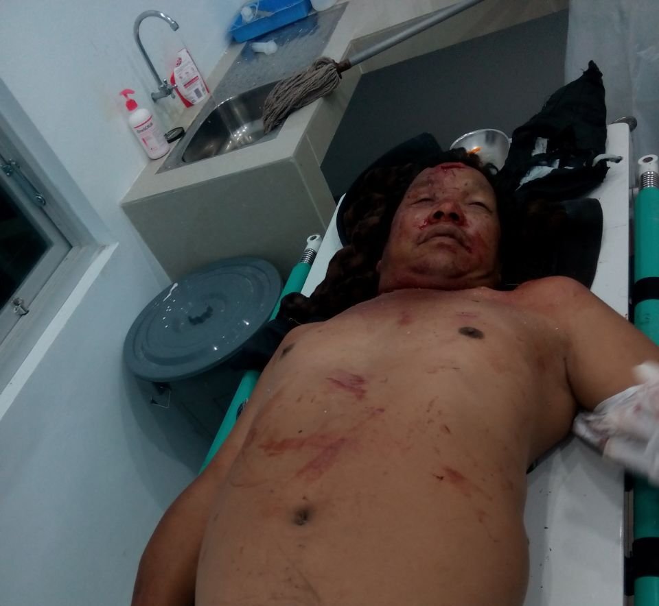 Akibat Ugal-ugalan Supir Pick-up Tewas