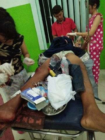 Ditabrak Truk Kaki 2 ABG Patah