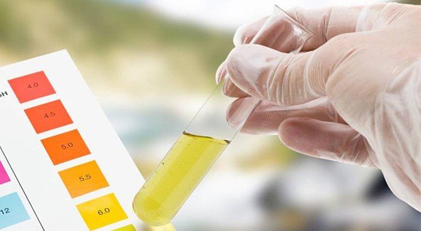 Ganti dan Tes Urine Pejabat Pemko Medan