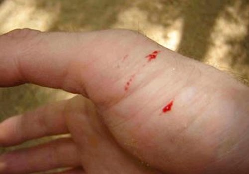 Cara Mudah Hindari Gigitan Ular di Hutan