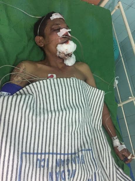 Pembobol Toko Ponsel Nyaris Tewas di Massa