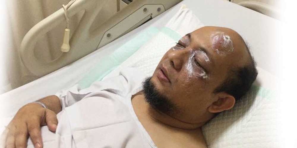 Mata Penyidik KPK Disiram Air Keras