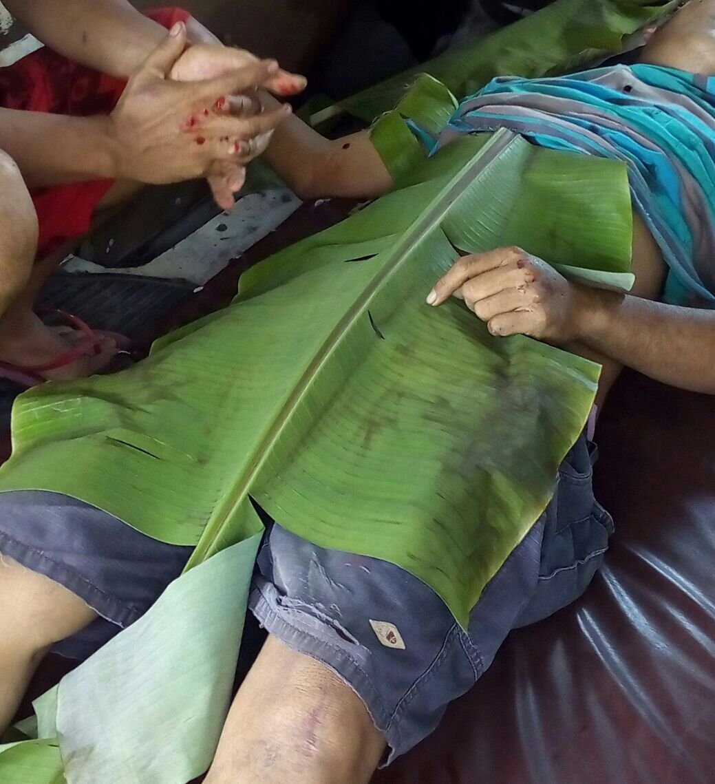 Timbul Tewas Motong Pick Up dan Ngerem Mendadak