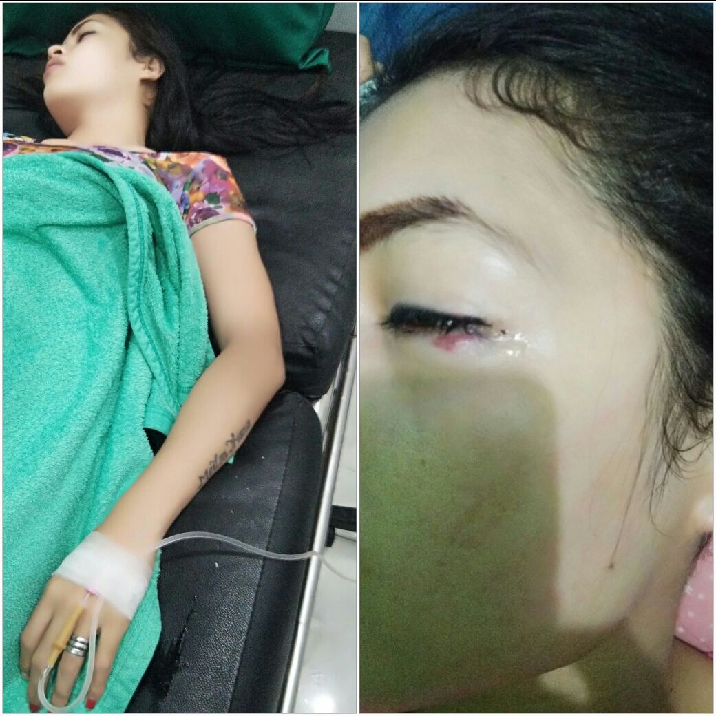 Salah Satu  Oknum Petugas Lapas Diduga Pukuli Waitres Cafe