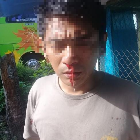 Polisi Berpangkat Brigadir Dianiaya Atasannya