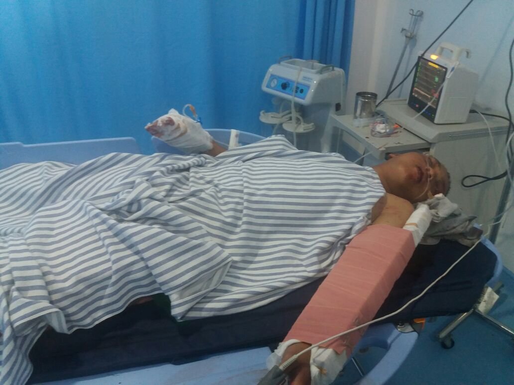 Jupiter Vs Ninja Laga Kambing, 1 Tewas 2 Luka Berat