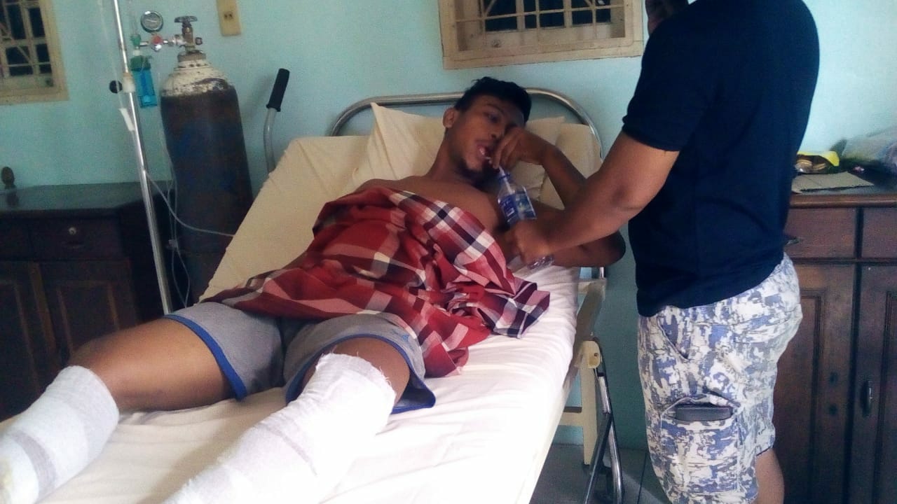 Tabung Gas Bocor Saat Hajatan, 13 Orang Luka, 2 Luka Serius