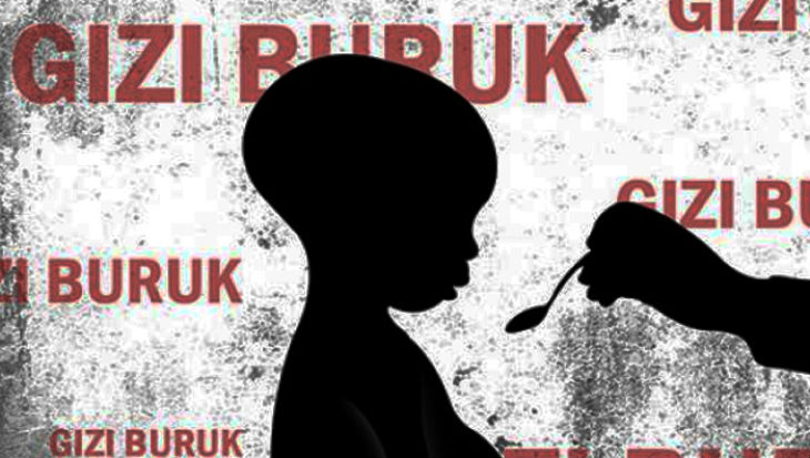 Balita Penderita Gizi Buruk Meninggal Dunia