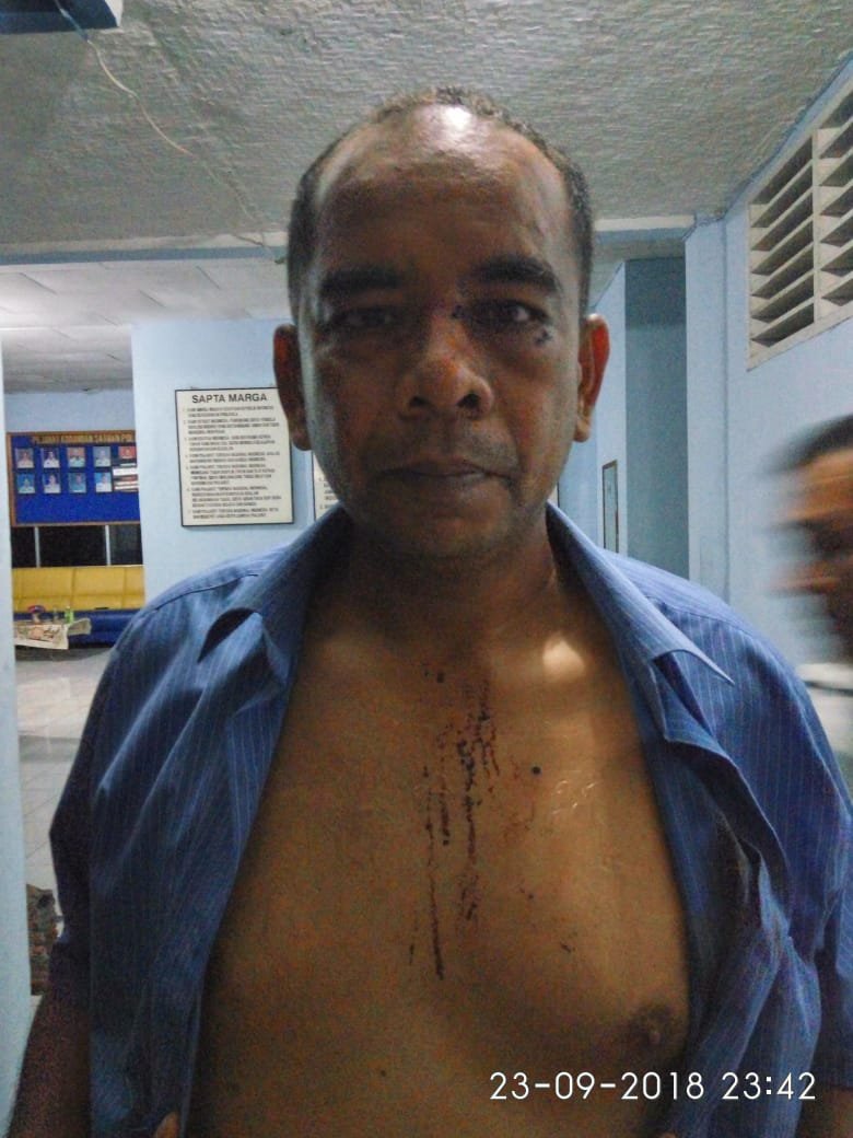 Di Sekap dan Dipukul Stik Baseball, Oknum TNI AU Babak Belur di Aniaya Pengusaha Play Station