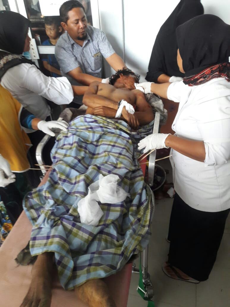 Akibat Angin KencanaÂ Warga Kenyaran Tewas Di Timpa Pohon