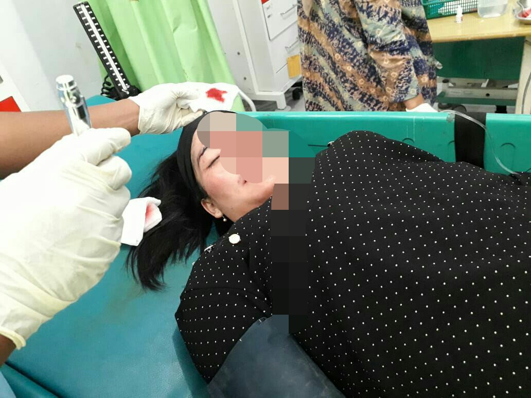Alami Api Cemburu Siti Ramiah Alami Luka Parah