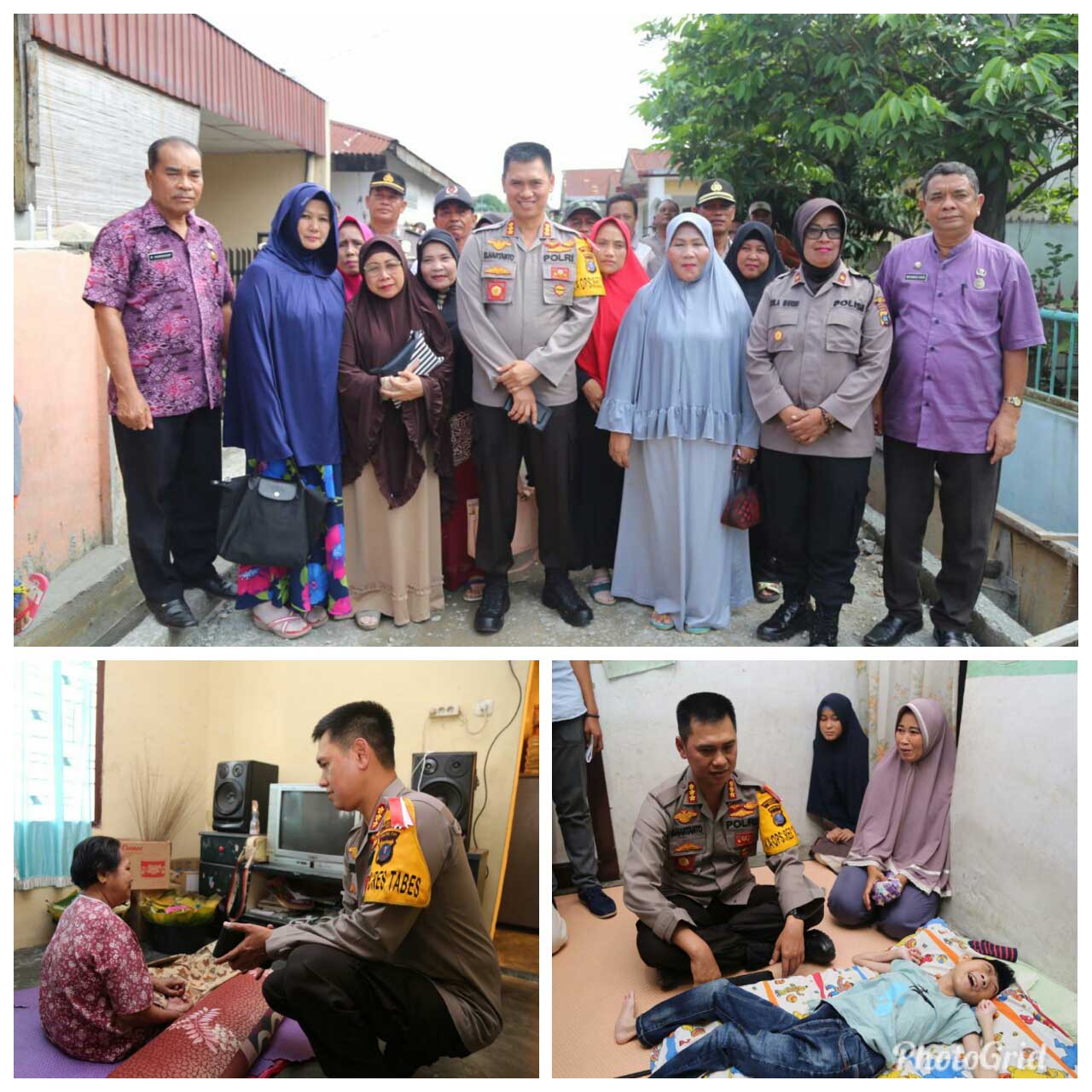 Dikunjungi Kapolrestabes Medan, Ibu Afmini Penderita Stroke dan Dimas Penderita Cacat Tempurung Terharu