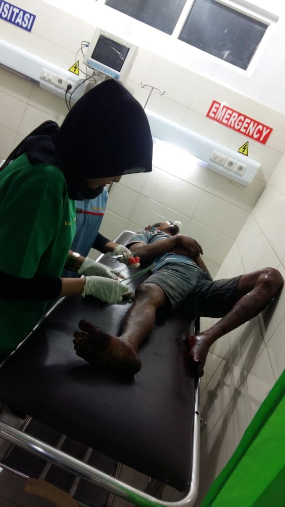 Pegasus Satreskrim Polrestabes Medan Tembak Pelaku Curat