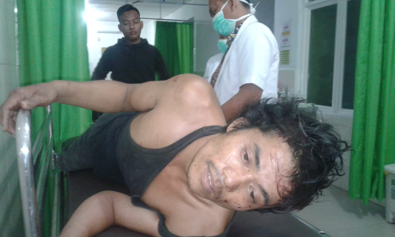 Satu Dari Dua Pelaku Curanmor Ditembak Pegasus Satreskrim Polrestabes Medan