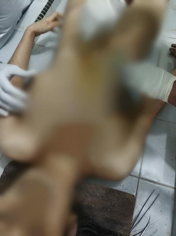 Diduga Minum Obat Penggugur Kandungan, ART Asal Nias Bersama Bayinya Ditemukan Meninggal Dunia