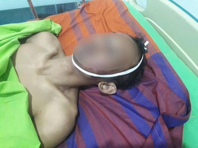 Gegara Payudara, Sumardin Tewas Dianiaya 3 Pria