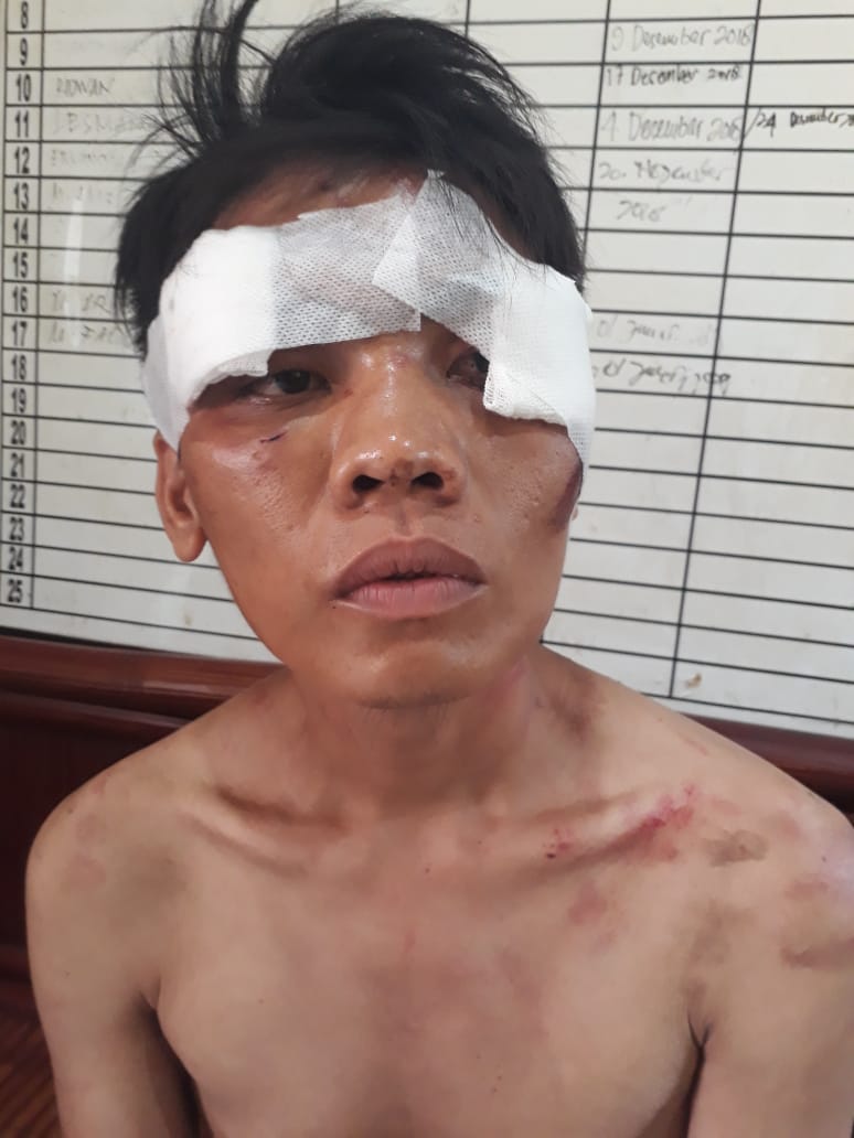 Pelaku Curanmor di Salon RINIE Diamankan Pegasus Medan Area
