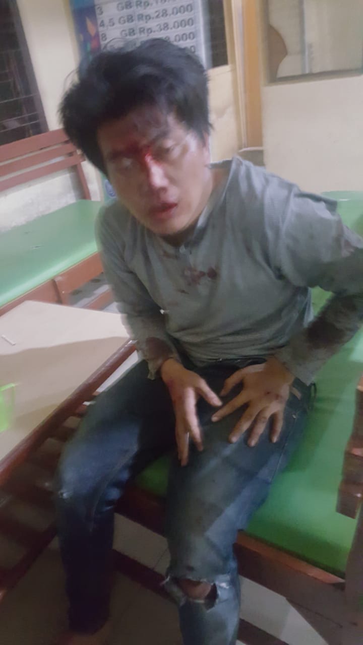 Pelaku Jambret Diwilkum Polsek Medan Kota Nyaris Tewas Dihajar Massa