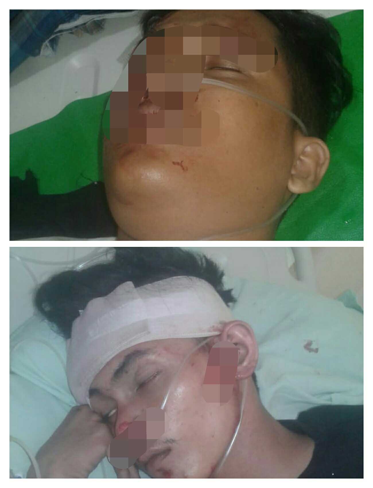 Duo Kawanan Jambret Diringkus Pegasus Polsek Sunggal