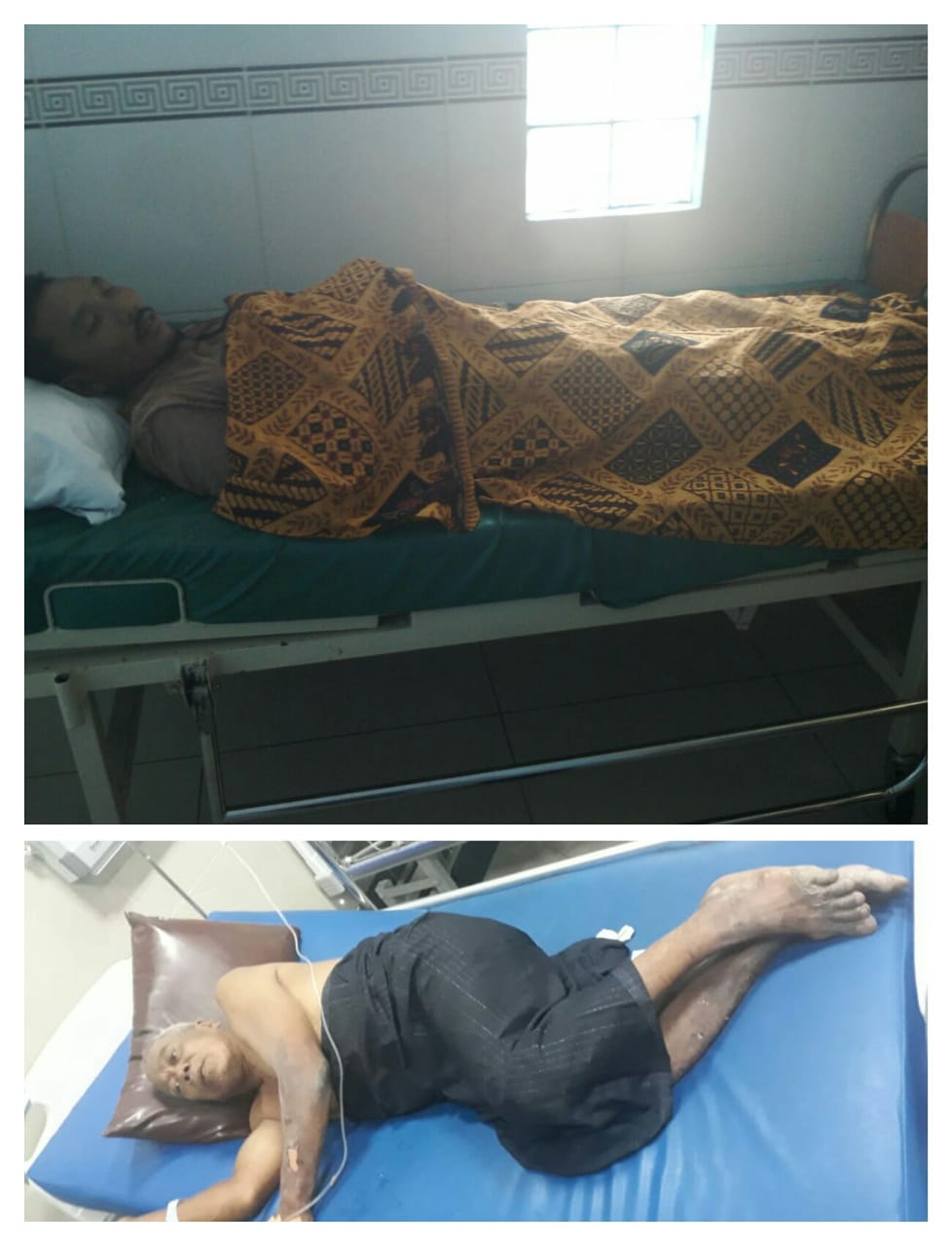 Tersengat Listrik, Parmun Alami Luka Bakar dan Waldi Meninggal Dunia