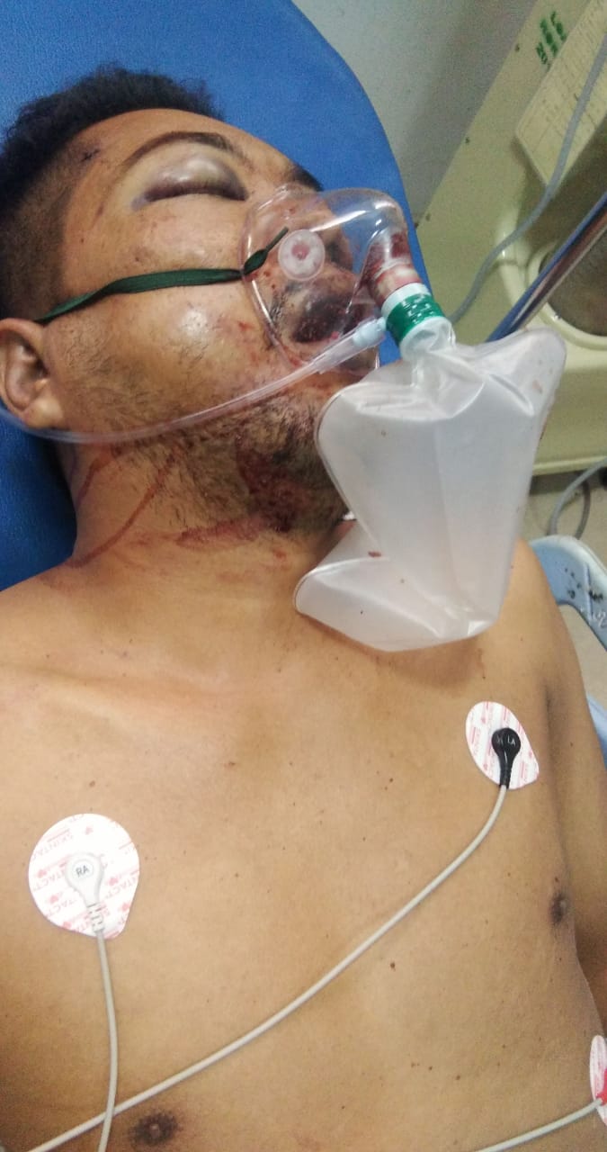 Tewasnya Kordinator Kuasa Hukum Walhi Menjadi Perhatian Publik di Sumut, Humas Poldasu : Kita AtensiÂ 