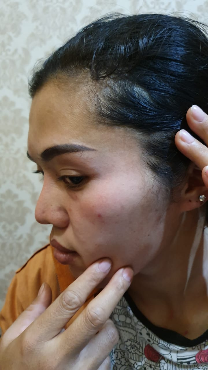 Wanita Hamil 5 Bulan Babak Belur Dianiaya Tetangganya