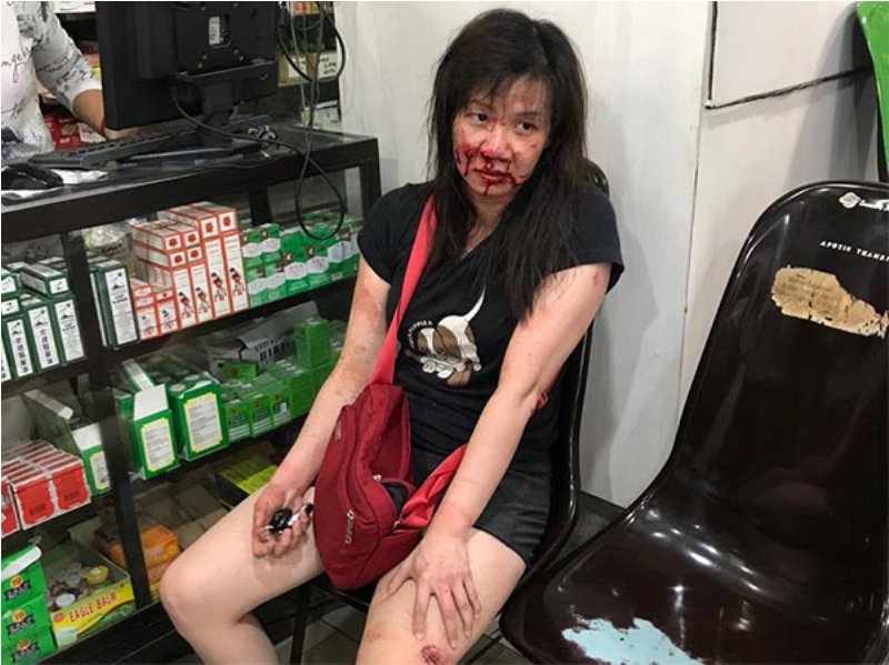 Wanita Tionghoa Disekap dan Ditikam Perampok Dalam Mobil, Korban Enggan Membuat Laporan Resmi Ke Polisi