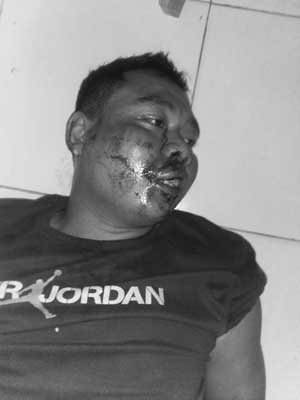 Pelaku Curanmor Satu Bonyok Â Satu Kabur, Ini Kata Kapolsek Beringin