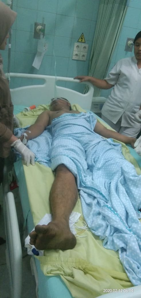 Polsek Sunggal Amankan 2 Pelaku Curanmor Diamuk Massa