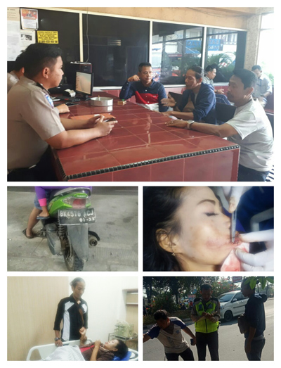 Korban Lakalantas di Ngumban Surbakti Berharap Pengendara Penabrak Dirinya Ditangkap