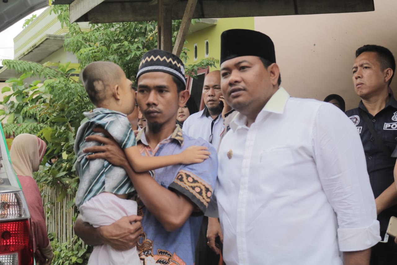 Wali Kota Tanjungbalai Fasilitasi Pengobatan Muhammad Al Wahdy Penderita Tumor Ganas