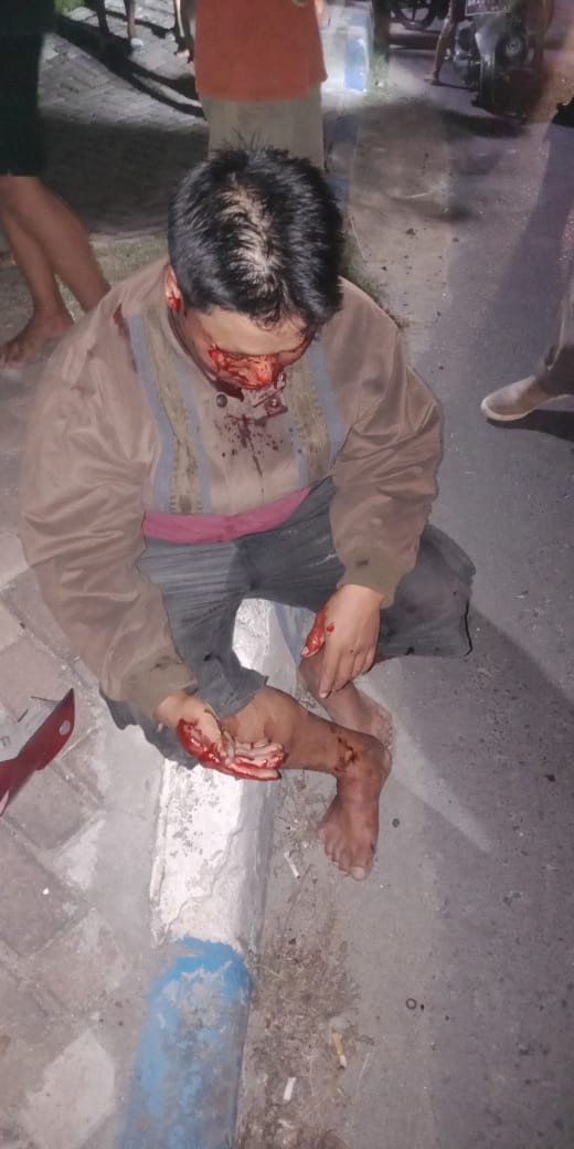 Pengendara Adu Banteng, Kapolsek Batang Kuis Polresta DS : â€œJangan Hanya Karena Ingin Lebih Cepat Semenit Dua Menit, Nyawa Jadi Taruhannya â€