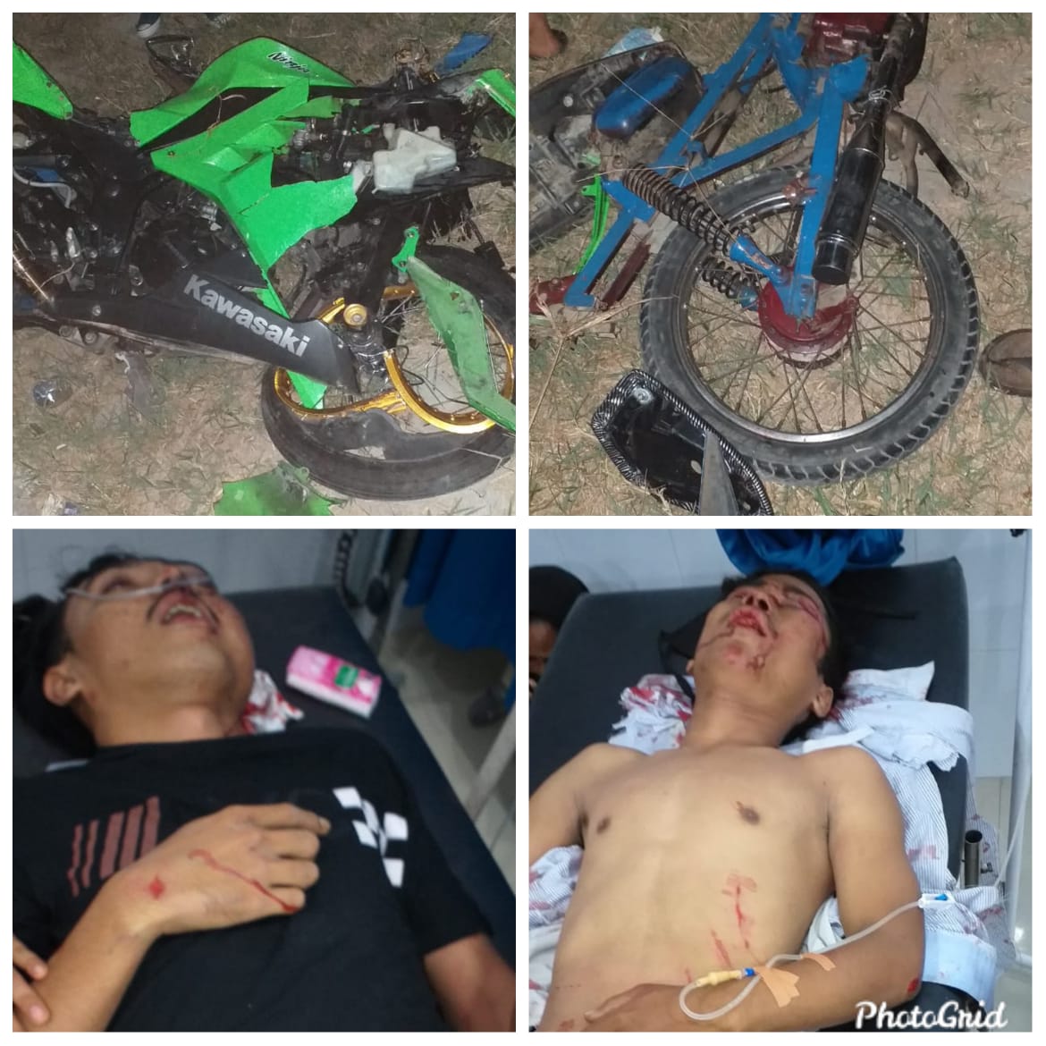 Diduga Balap Liar, Pengendara Ninja dan Kanzen Kondisinya Kritis