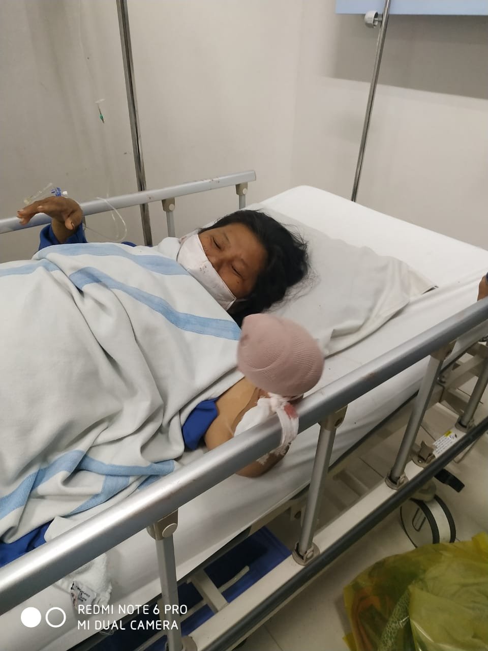 Begal Mengganas di Jalan AR Hakim Medan, 4 Jari IRT Putus Disabet Sajam