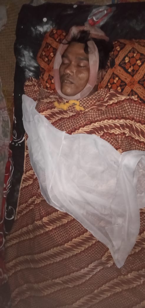 Bermain HP Duda Tewas, Ini Penyebabnya