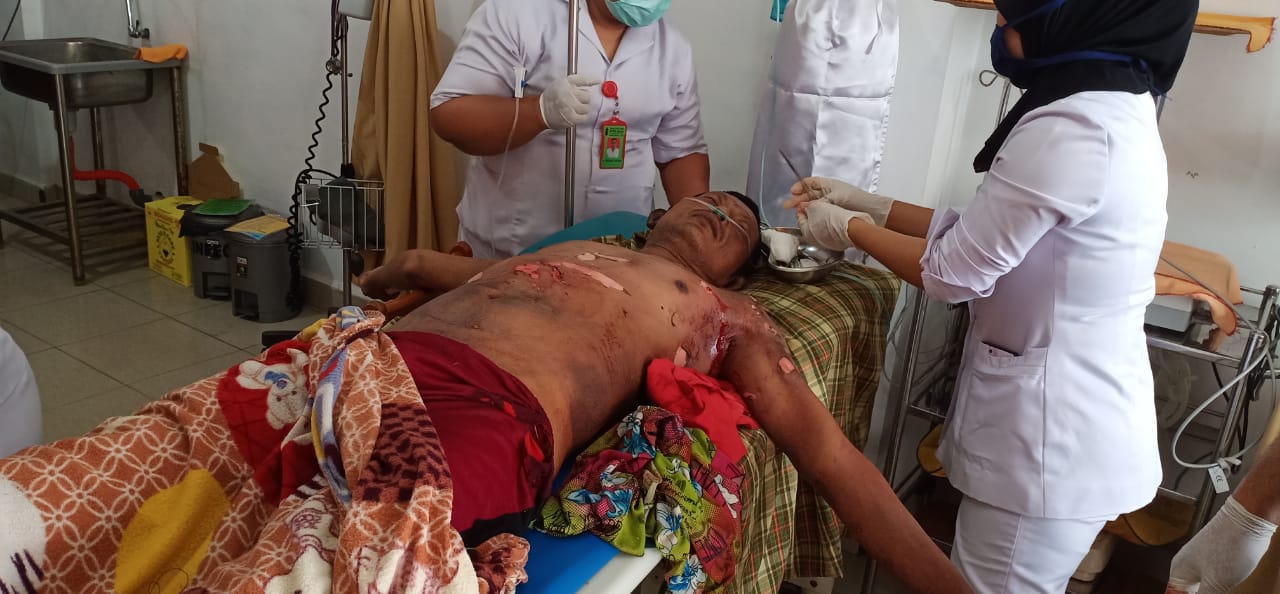 Seorang Ayah Berulangkali Bunuh Diri  Putrinya Menggagalkan Aksi Korban