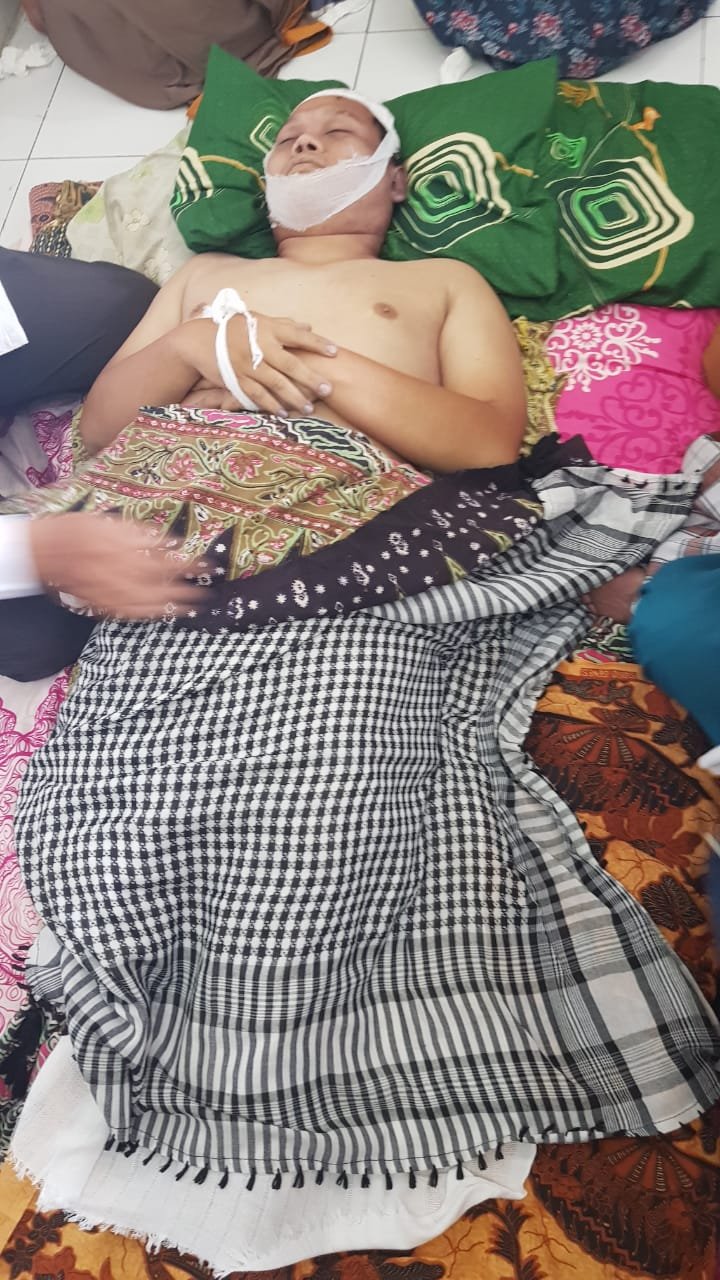 Seorang Pria di Deli Serdang Tewas Tersengat Listrik