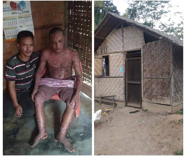 Nano Menderita Sakit Aneh Tanpa Perawatan, Butuh Bantuan Dermawan