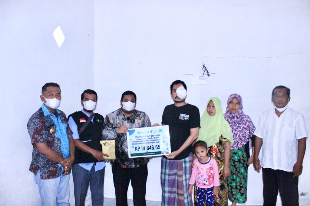 DD Waspada-MumuApps Bantu Melky Penderita Kanker Mata