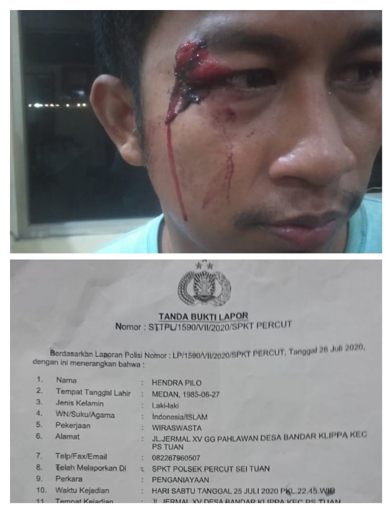 Hendra Pirlo Pedagang Makanan Bonyok Dianiaya AC cs Preman Jermal XV, Kanit Reskrim : Masih Dicek ke Penyidik