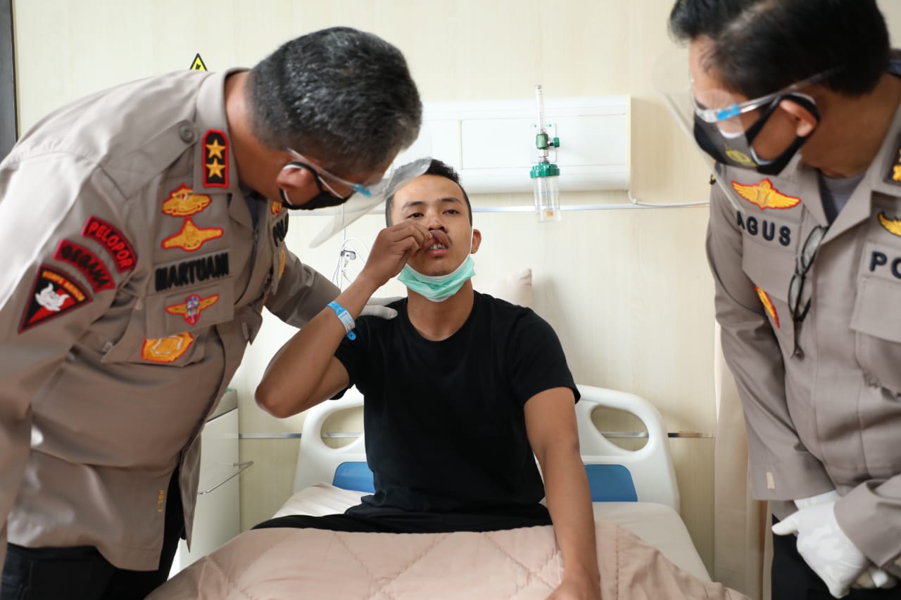 Kapoldasu Jenguk Personil Terluka Saat Amankan Demo Anarkis