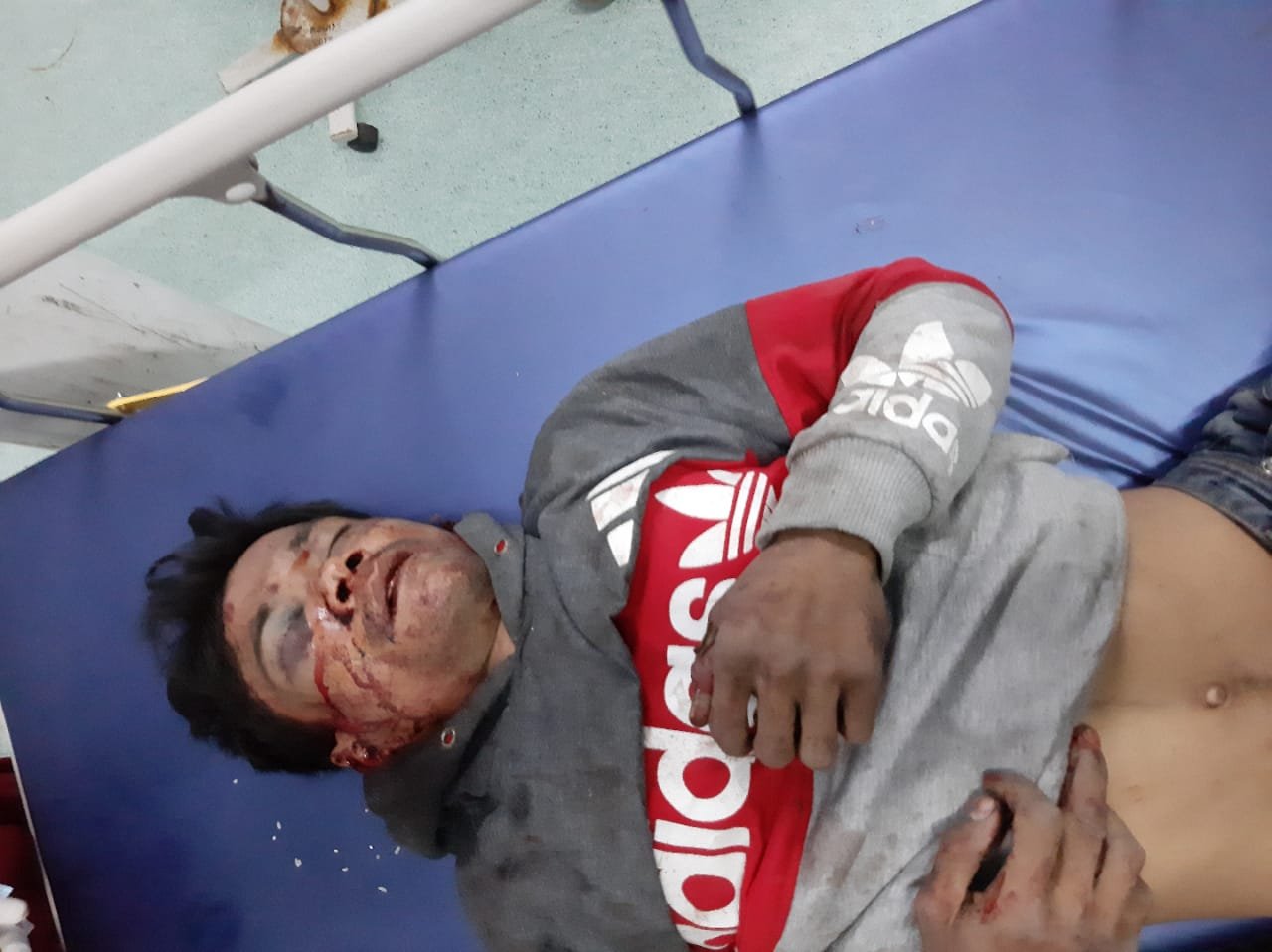 Ketakutan Dikejar Warga, Lelaki Bertato Spiderman Terkapar Dibawah  Pohon Karet