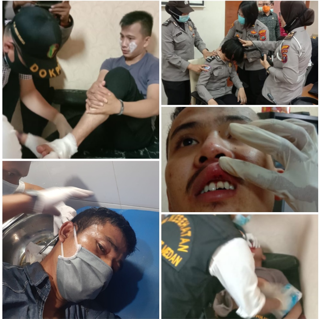 Pasca Pengamanan Unjukrasa di DPRD Sumut, 13 Polisi Luka-Luka, 3 Perwira dan 1 Polwan