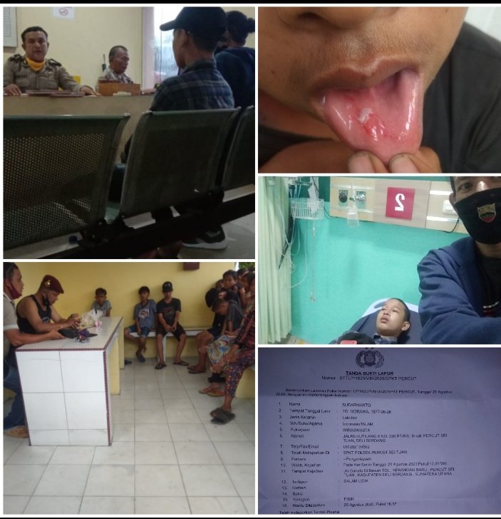 Orang Tua Rendy Korban Penganiayaan Oknum Diduga Polisi Minta Laporanya Segera Tangkap Pelaku