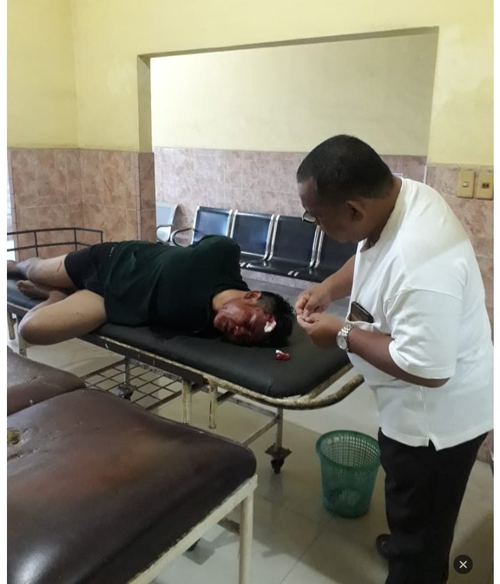 Curi Septor Di Teras Rumah Warga, Pelaku Bonyok Dibalbal Massa