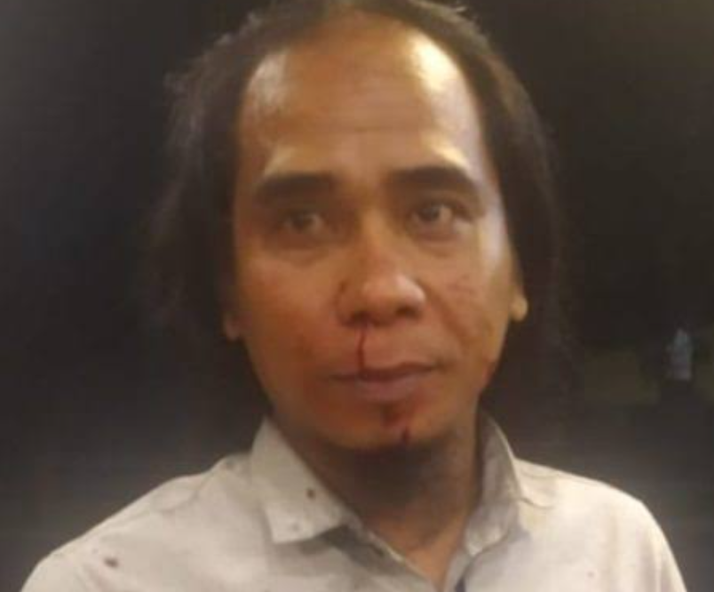 Terus Diteror, Aktivis Anti Korupsi Kabur Dari Rumah Sakit Di Sergai Ngadu ke Poldasu
