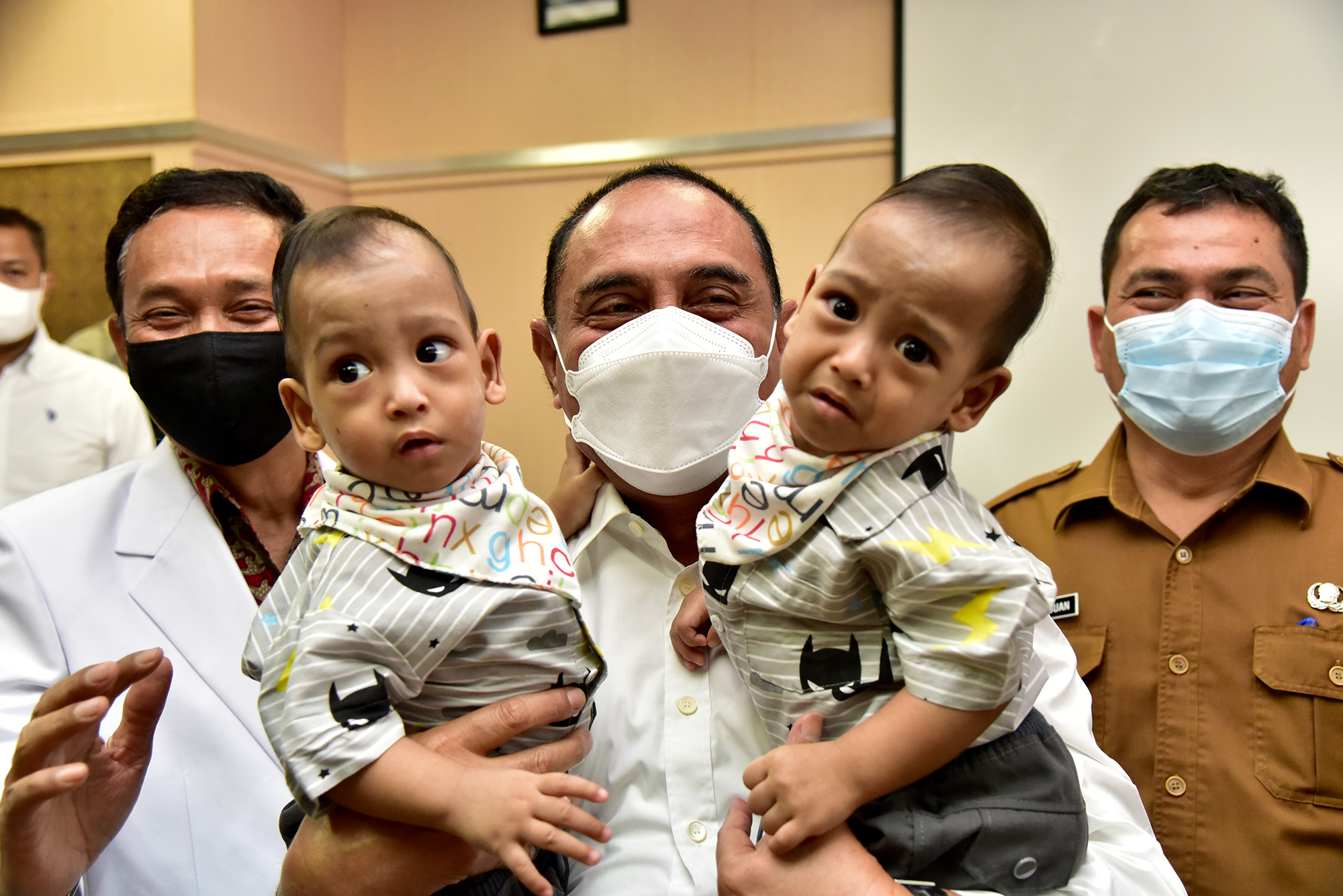 Adam dan Aris Diperbolehkan Pulang,  Gubernur Edy Rahmayadi Apresiasi  Tim Dokter Pemisahan Kembar Siam
