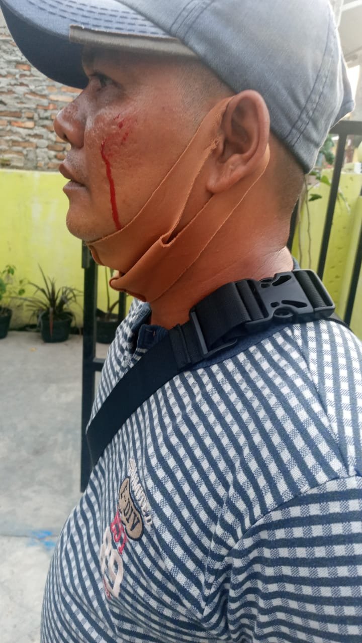 Bentrok di Jalan Metrologi Sampali, 1 Orang Terkena Lemparan Botol Kaca