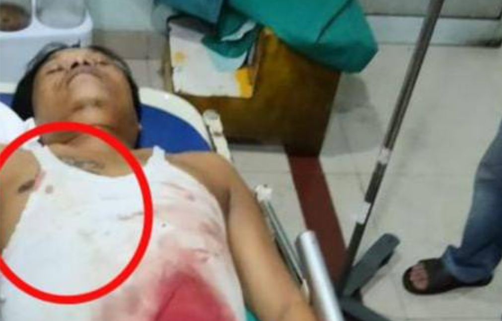Penembakan Wartawan di Siantar, PWI : Polisi Harus Tangkap Pelaku